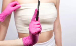 Mastectomie FOTO Shutterstock 