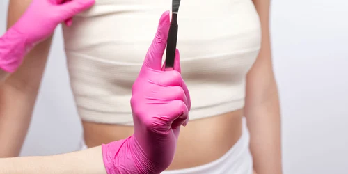 Mastectomie FOTO Shutterstock 