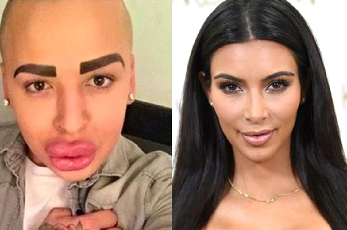 
    Şi-a distrus chipul ca să arate ca Kim Kardashian  