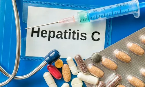 hepatita c 486755824 jpeg