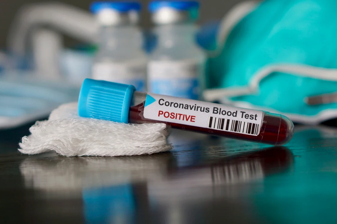 Pandemia de coronavirus face ravagii în lume FOTO Shutterstock