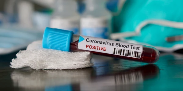 Coronavirus covid 19 imagine generica FOTO Shutterstock