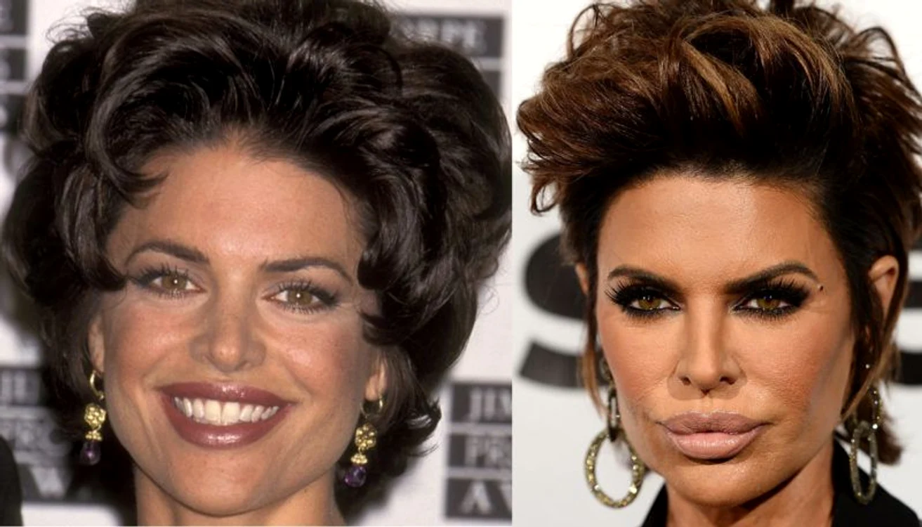 
    Lisa Rinna  