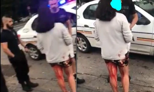 O copilă, despre care s a aflat ulterior că are 14 ani, mergea plină de sânge pe abdomen şi pe picioare pe un bulevard central din Galați jpeg