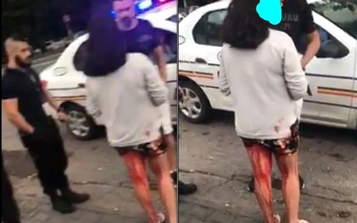 O copilă, despre care s-a aflat ulterior că are 14 ani, mergea plină de sânge pe abdomen şi pe picioare pe un bulevard central din Galați
