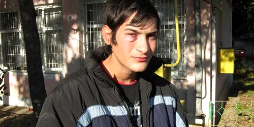 Ionuţ Asaftei susţine că are ochiul vânăt pentru că a fost abuzat fizic de şeful Centrului "Prietenia"