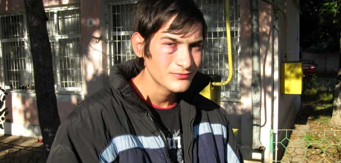 Ionuţ Asaftei susţine că are ochiul vânăt pentru că a fost abuzat fizic de şeful Centrului "Prietenia"