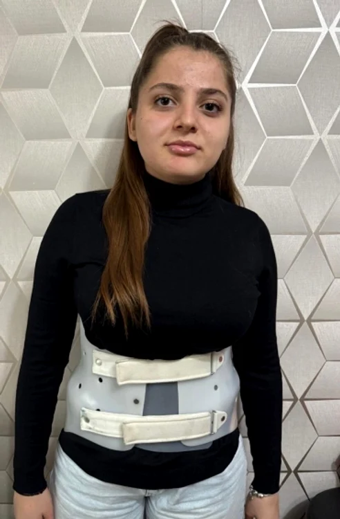 Alexandra poartă de peste un an un corset special, dar boala și așa a avansatFOTO: salveaza o inimă 