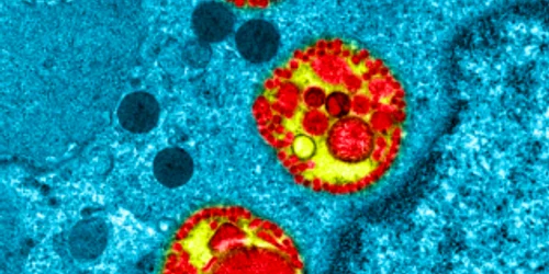 Coronavirus Sursa news.ro