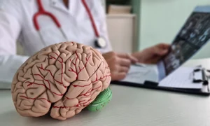 Accident vascular cerebral, shutterstock jpg