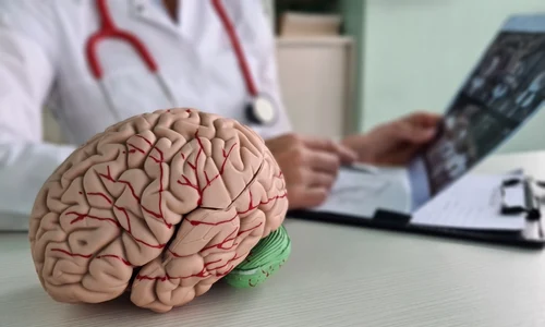 Accident vascular cerebral, shutterstock jpg