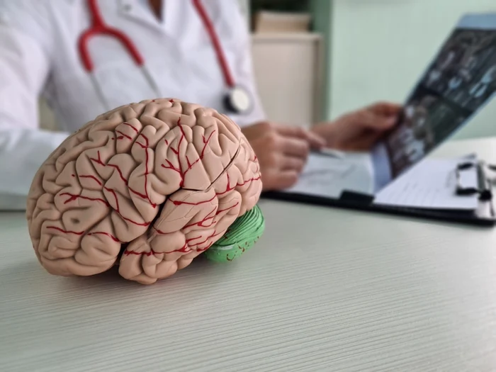 Cele cinci obiceiuri esențiale care pot reduce riscul de a suferi un AVC / foto: Shutterstock