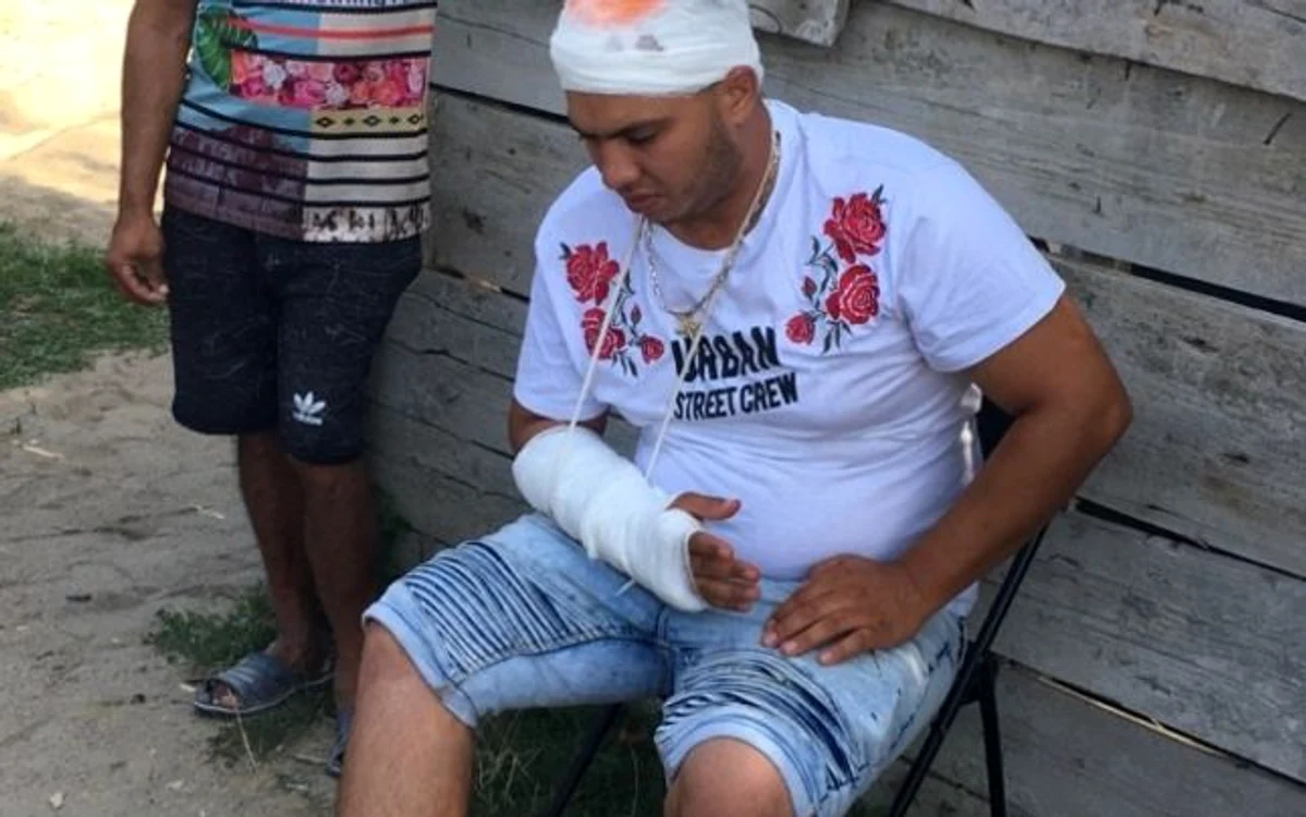 
    Două familii de romi din Podari s-au războit din cauza unui teren Foto: adevarul.ro  