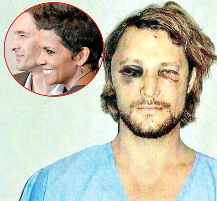 Gabriel Aubry (37 de ani) a ieşit cam şifonat din luptă