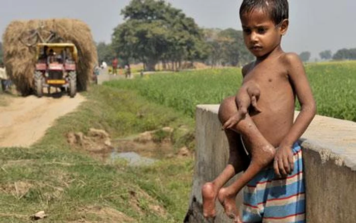 Micul indian cară cu el părţi din trupul fratelui mort