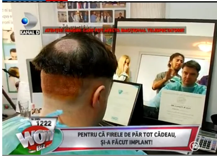 Andrei Duban după operaţie