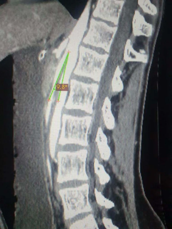 Din radiografie s-a stabilit problema medicală reală a adolescentei. Foto: Spitalul Judeţean Oradea
