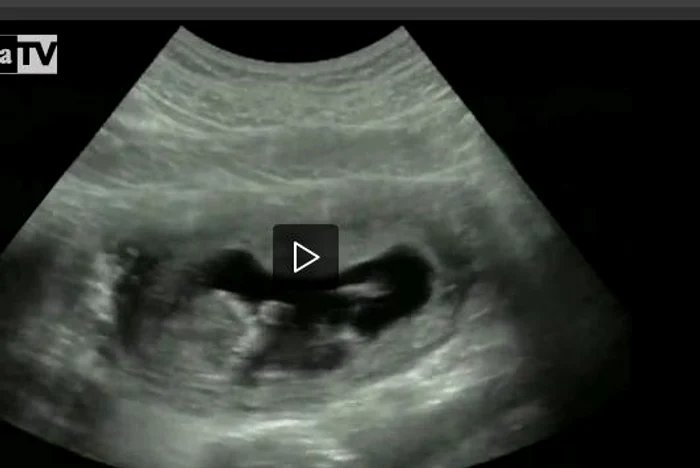 beyonce, ecografie fetita, beyonce documentar, beyonce blue ivy