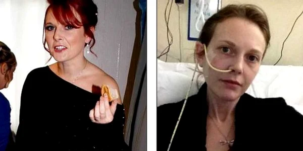 Natalie înainte şi după ce s-a îmbolnăvit