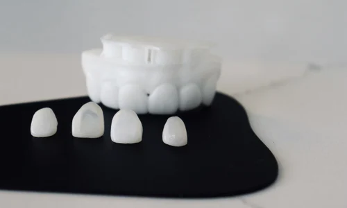 Fațete dentare vs coroane jpeg