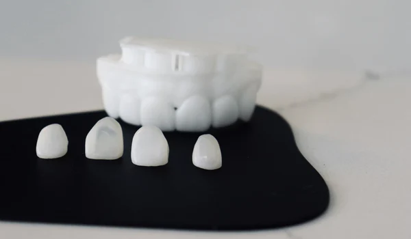 Fațete dentare vs coroane jpeg