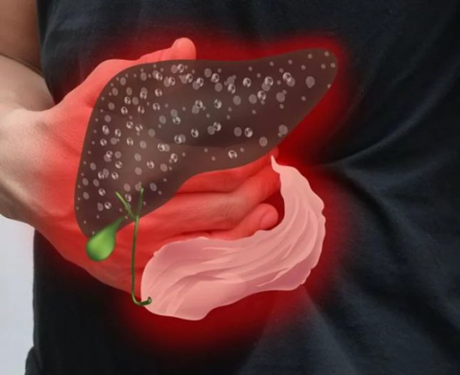 Metode simple pentru a curăţa ficatul de toxine