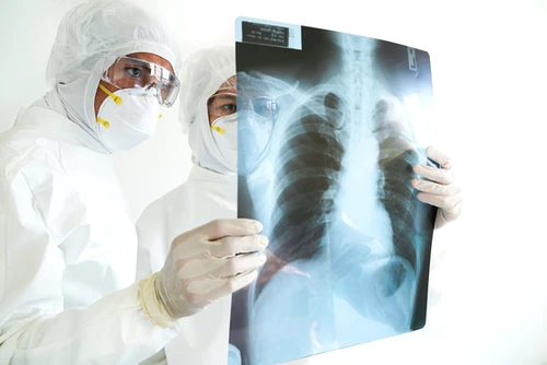 radiografie pulmonara shutter jpeg