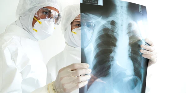 radiografie pulmonara shutter jpeg