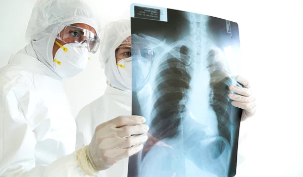 radiografie pulmonara shutter jpeg