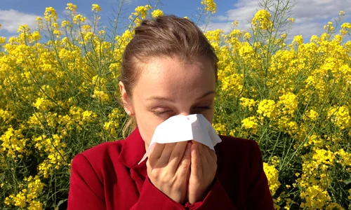 allergy g3d6759da5 1920 jpg