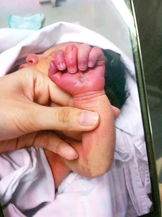 Mama a fost prinsă de o asistentă cu mânuţa copilului între dinţi