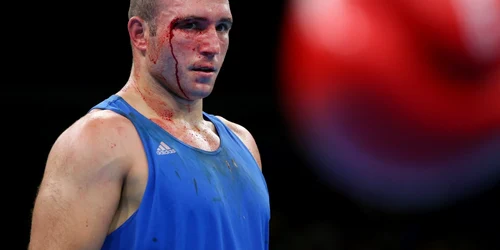 Românul Mihai Nistor sângerează după a fost învins de boxerul iordanian  Iashaish la Jocurile Olimpice de la Rio. FOTO Guliver/Gettyimages