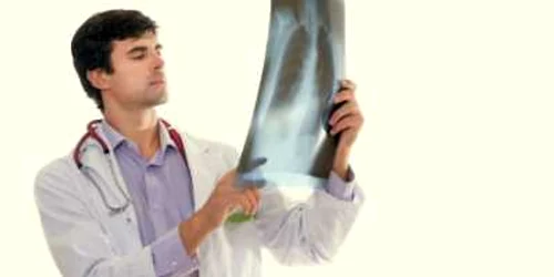 Radiografia toracică poate evidenţia prezenţa „apei la plămâni“