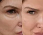 Rezultatele sunt vizibile, după tratamentele faciale, unele de ultimă generație