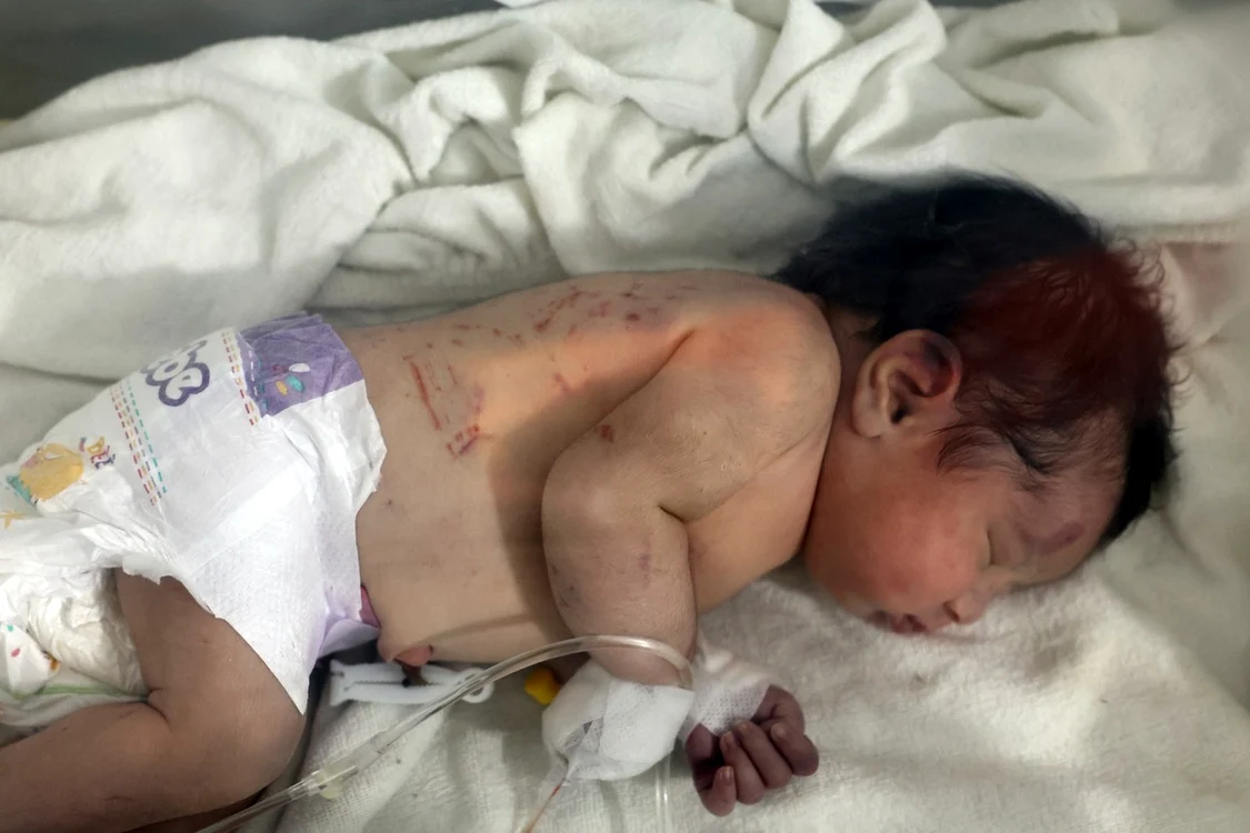Bebelusul născut sub dărâmături în Siria FOTO Profimedia 