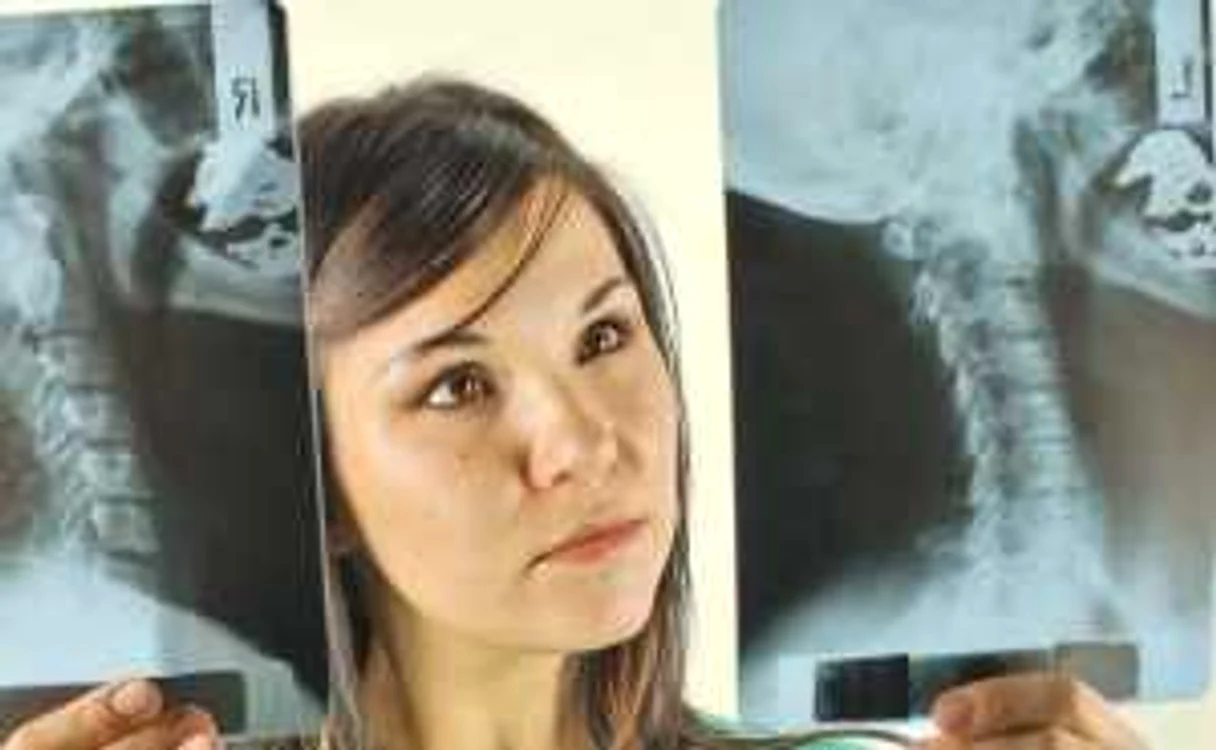 Creierul afectat de boala Alzheimer se micşorează în timp