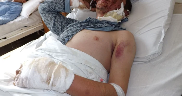 Daniel Constantin Căbulea (victima) pe patul de spital FOTO Corina Macavei