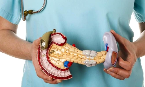 1 72777 original jpg jpeg