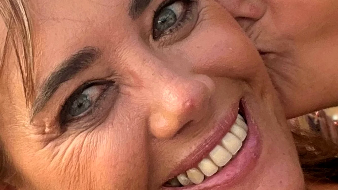 Michelle Davis înainte de a fi diagnosticată cu cancer de piele / foto: Social media