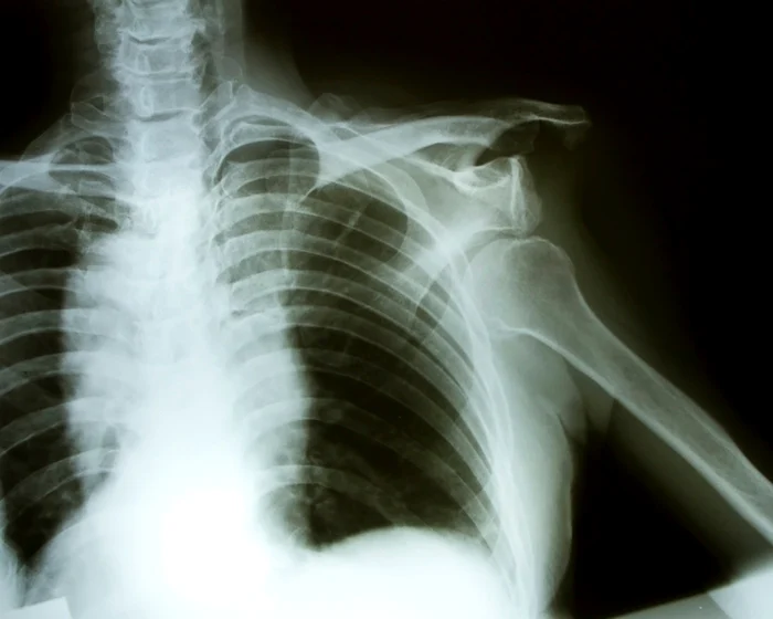 Lauren a fost supusă la cinci intervenţii medicale, fără a avea însă vreun rezultat      FOTO Shutter