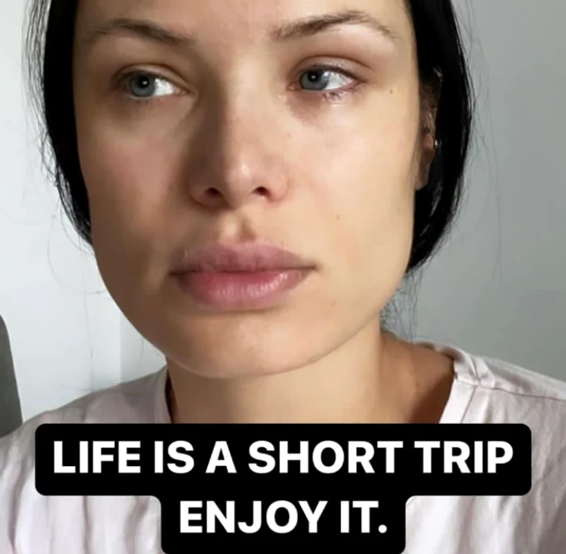 Irisha, accident grav în bucătăire / Sursa: Instagram