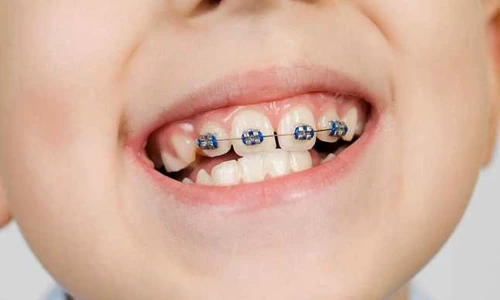 1 prat dentar jpg jpeg