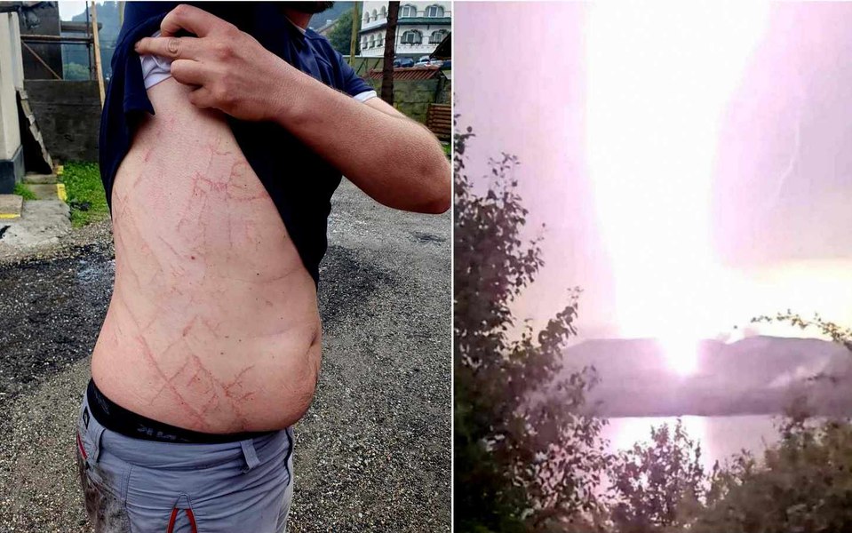 Cum arată o lovitură de fulger pe pielea unui supraviețuitor. Sfaturi prețioase de la Salvamont: când să ne așezăm pe vine FOTO