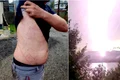 Urme lăsate de fulger pe corpul unui om  Foto Salvamont Argeș Facebook jpg