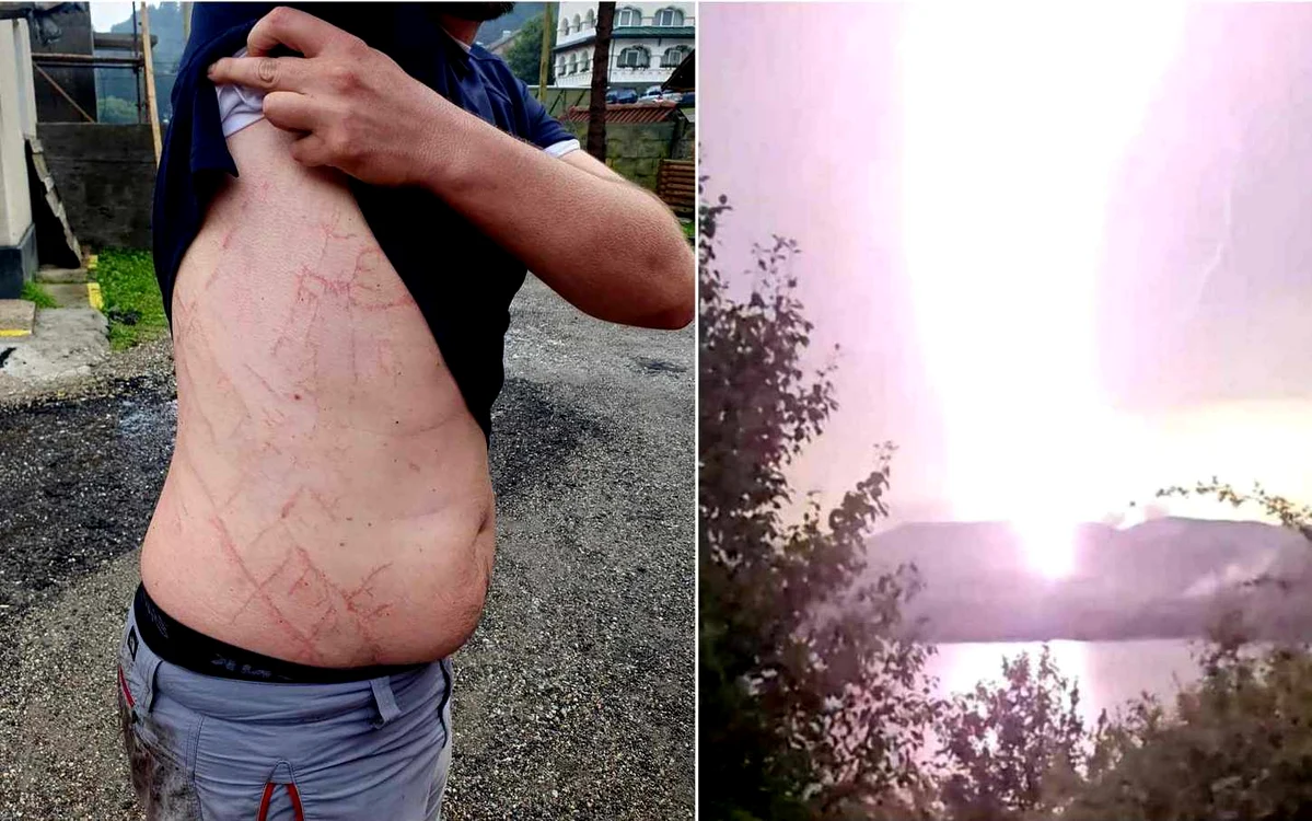 Bărbatul care a fost lovit de fulger Foto: Facebook