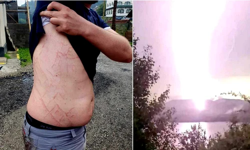 Urme lăsate de fulger pe corpul unui om  Foto Salvamont Argeș Facebook jpg