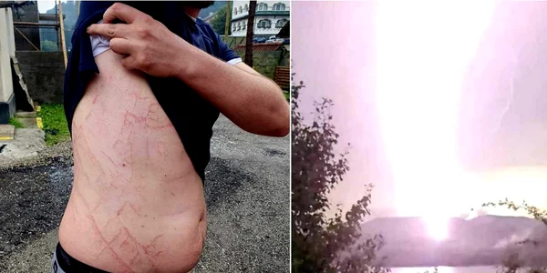 Urme lăsate de fulger pe corpul unui om  Foto Salvamont Argeș Facebook jpg
