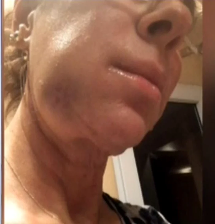 Teo Trandafir se simte bine, deşi este umflată