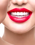 dinti albi shutterstock 673659349 jpg