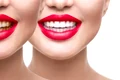 dinti albi shutterstock 673659349 jpg